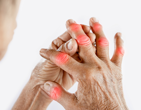 Understanding Pain and Arthritis: Exploring the Connection